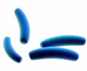 legionella